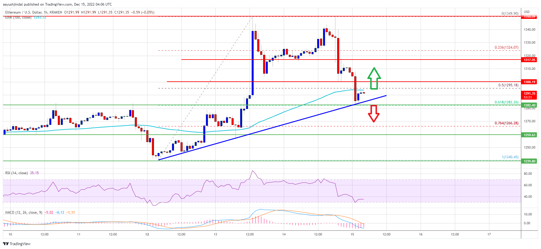 Ethereum Preis