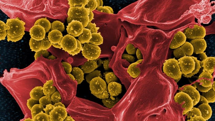„Wirksames“ Antibiotikum verstärkt Kampf gegen Superbakterien