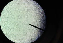 Bitcoin oder Tulpenmanie? Ein Vergleich der Extremwerte